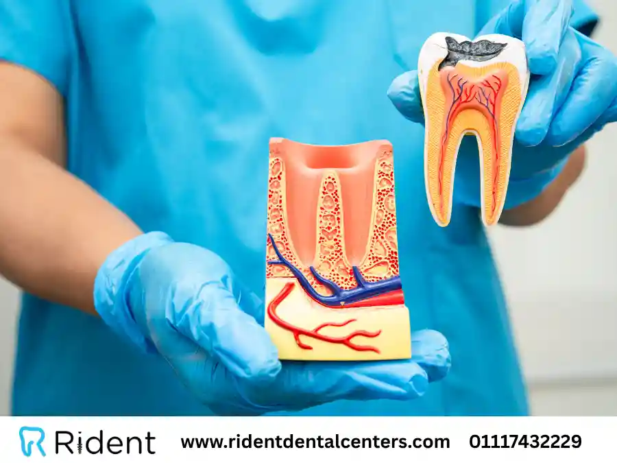 سعر حشو العصب في مصر 2025